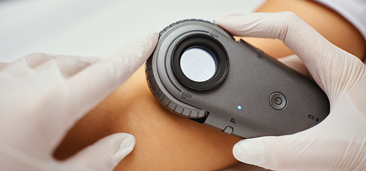 LeoPharma_Dermatoscopia_2024