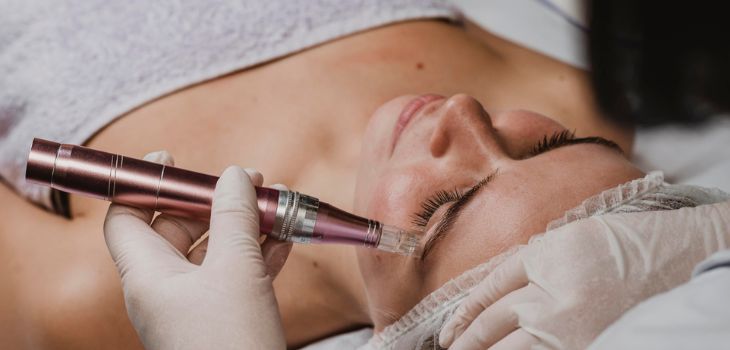 làser facial