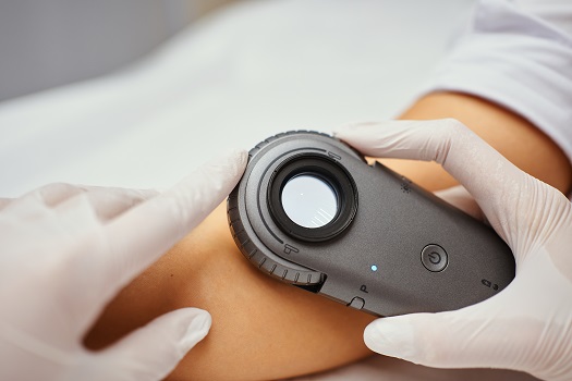 L’IFMiL i Leo Pharma impulsen un cicle de webinars sobre dermatologia en Atenció Primària